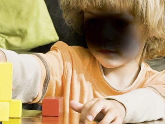 Die AMD-typischen dunklen Flecken im zentralen Gesichtsfeld bereiten auch Probleme beim Erkennen von Gesichtern. Ein kleines Kind mit einem großen, schwarzen Fleck vor dem Gesicht, spielt mit Holzbausteinen. Der Fleck symbolisiert die Sicht eines Menschen, der an AMD, Alterbedingter Makula-Degeneration leidet.